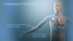 Parenteral Nutrition Market