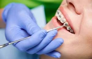 Orthodontic Market